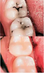 infantil-antes-despues-2